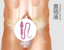 精液少怎么回事?该怎么进行治疗呢?