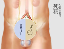 死精症的病因有哪些?