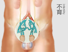 商丘男性不育的检查项目都有哪些?